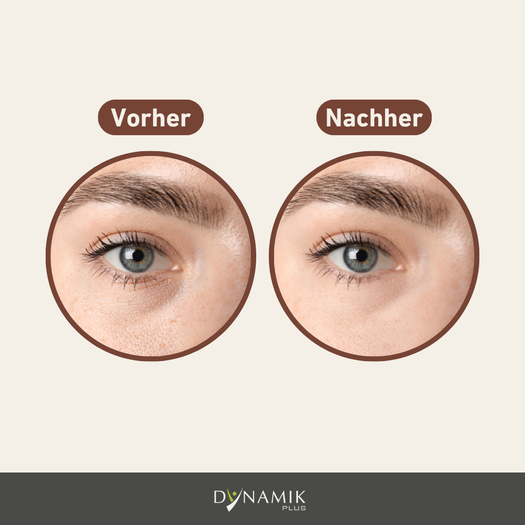 Vorher Nacher Vergleich Relift Augenserum